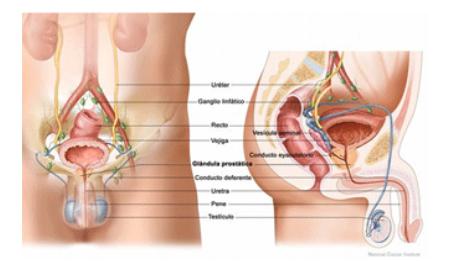 Cáncer de Próstata